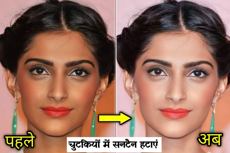 how to get rid from sun tan in hindi