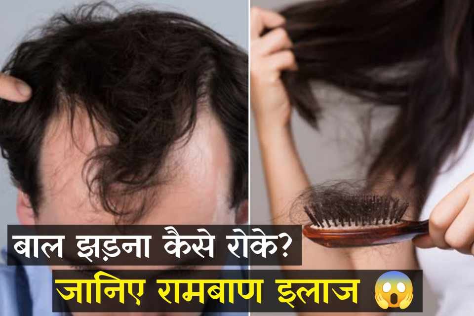 बालों को झड़ने से रोकने का इलाज